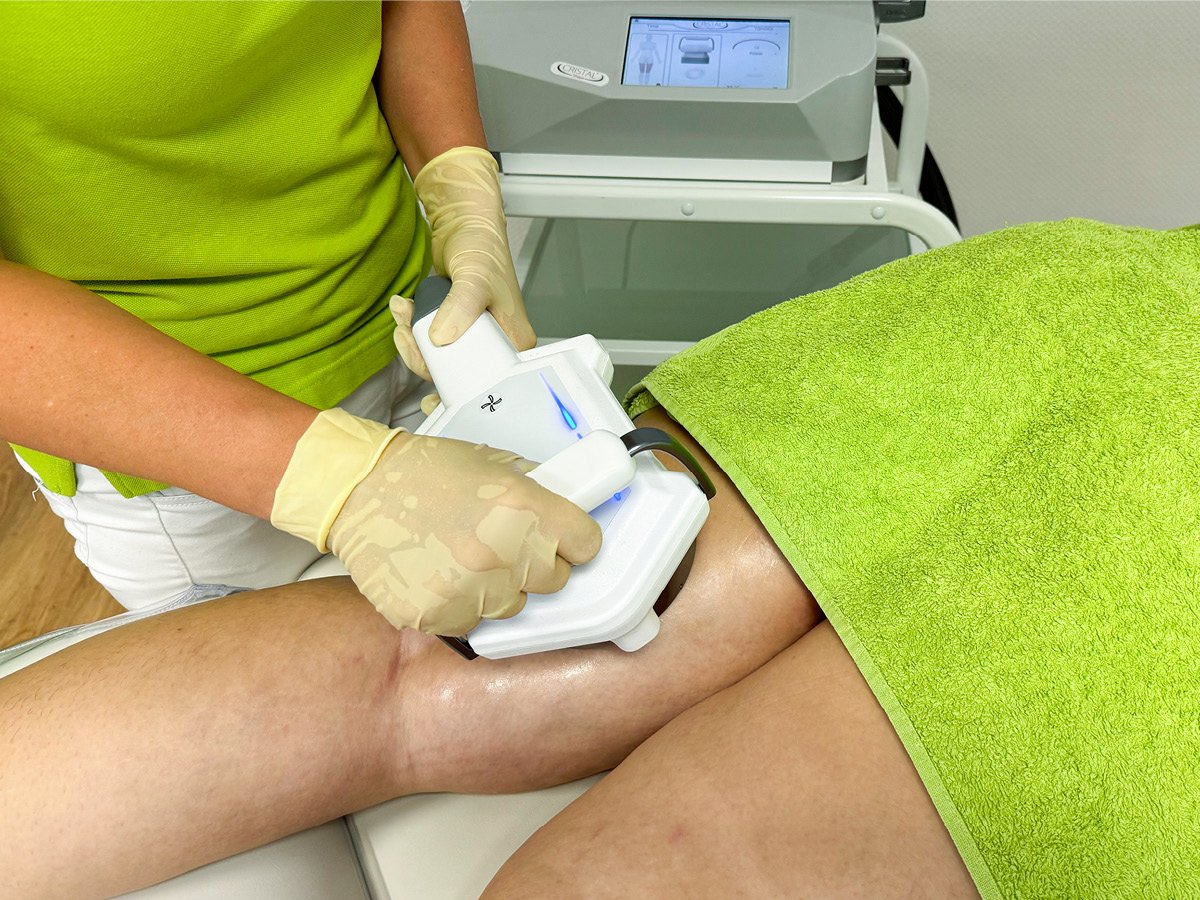 Behandlung Cellulite-Behandlung in Berlin